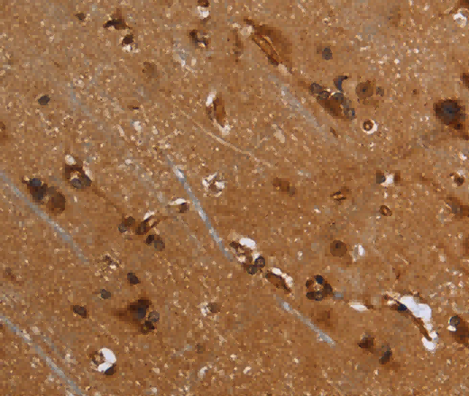 FLNA Polyclonal Antibody - 3