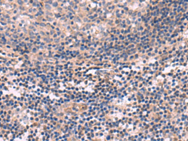 Immunohistochemistry of paraffin-embedded Human tonsil tissue  using KCNT1 Polyclonal Antibody at dilution of 1:30(?200)