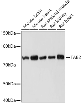 Western blot analysis of extracts of various cell lines using TAB2 Polyclonal Antibody at 1:1000 dilution.