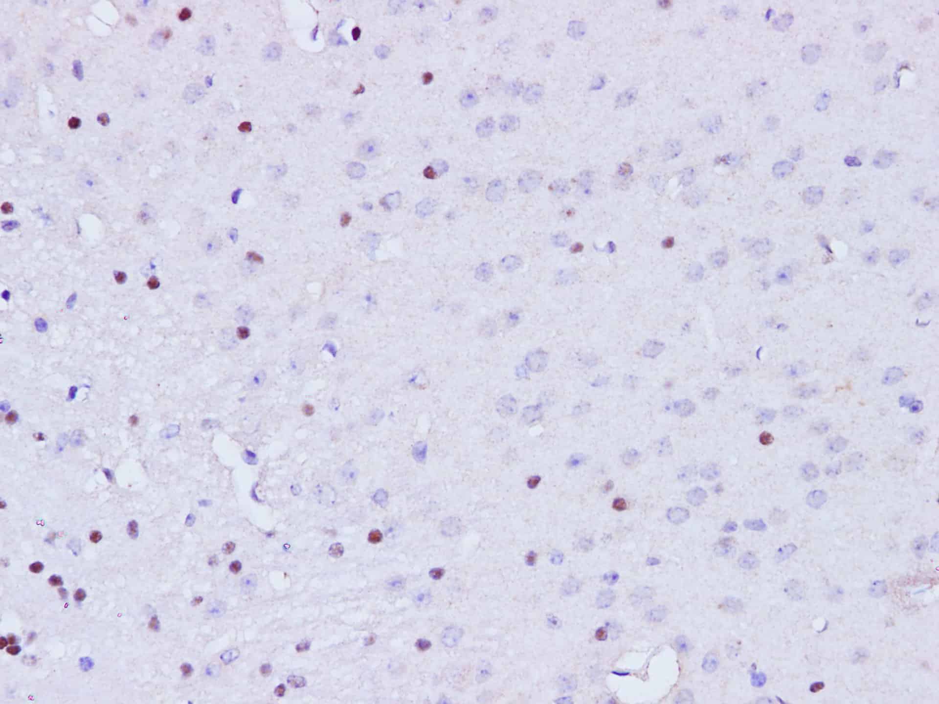 Immunohistochemistry of paraffin-embedded Mouse brain using BRCA1 Polyclonal Antibody at dilution of 1:100