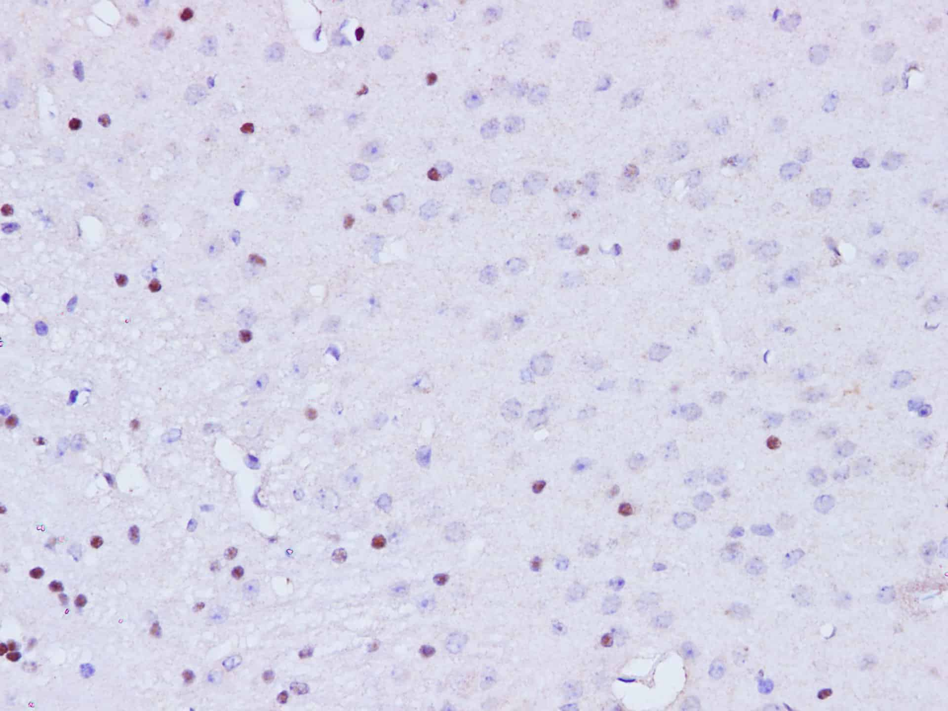 Immunohistochemistry of paraffin-embedded Mouse brain  using BRCA1 Polyclonal Antibody at dilution of 1:100