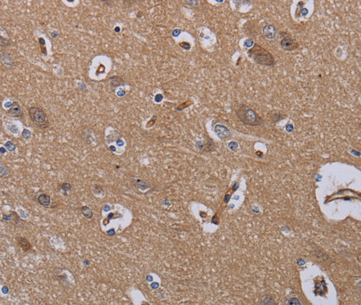 Immunohistochemistry of paraffin-embedded Human brain using ZC3H12A Polyclonal Antibody at dilution of 1:40