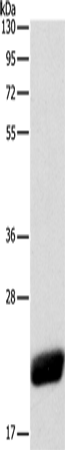 Western Blot analysis of Human leiomyosarcoma tissue using CAV1 Polyclonal Antibody at dilution of 1:525