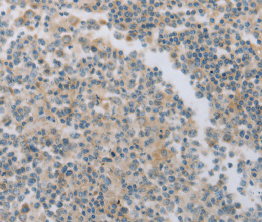 Immunohistochemistry of paraffin-embedded Human tonsil using MAGED1 Polyclonal Antibody at dilution of 1:30