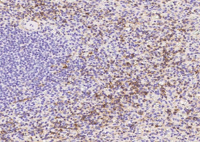 Recombinant PSGL-1/CD162/SELPLG Monoclonal Antibody - 2
