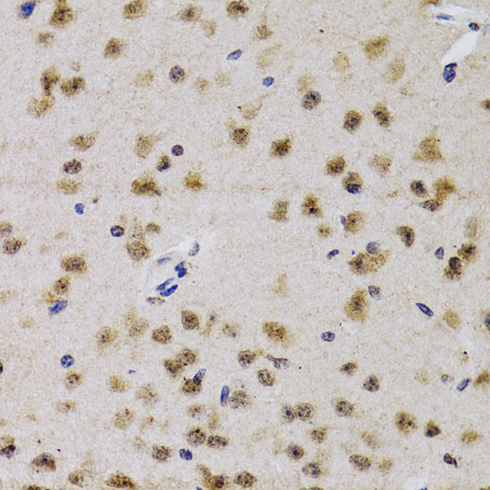Immunohistochemistry of paraffin-embedded Mouse brain using CDK7 Polyclonal Antibody at dilution of 1:200 (40x lens).