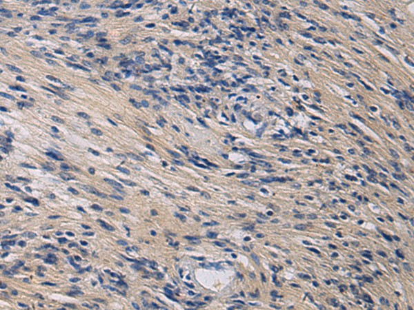 Immunohistochemistry of paraffin-embedded Human brain tissue  using KLF1 Polyclonal Antibody at dilution of 1:35(?200)