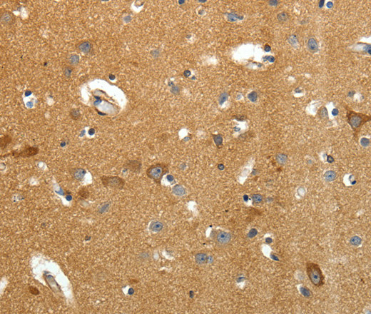 Immunohistochemistry of paraffin-embedded Human brain tissue using AMD1 Polyclonal Antibody at dilution 1:40