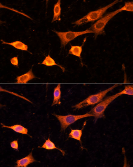 Immunofluorescence analysis of NIH-3T3 cells using BFAR Polyclonal Antibody at dilution of  1:100 (40x lens). Blue: DAPI for nuclear staining.