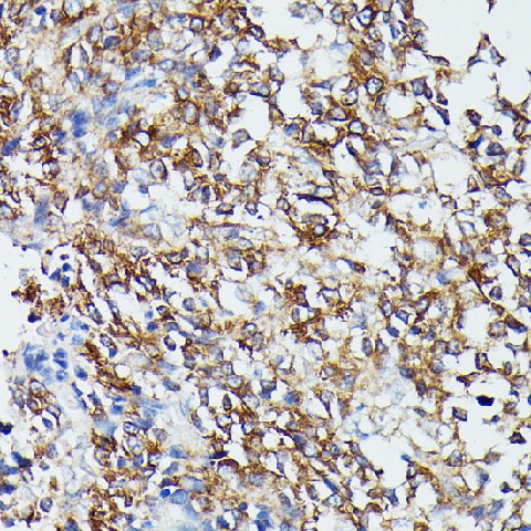 Immunohistochemistry of paraffin-embedded Human appendix using MAP2K5 Polyclonal Antibody at dilution of  1:100 (40x lens).