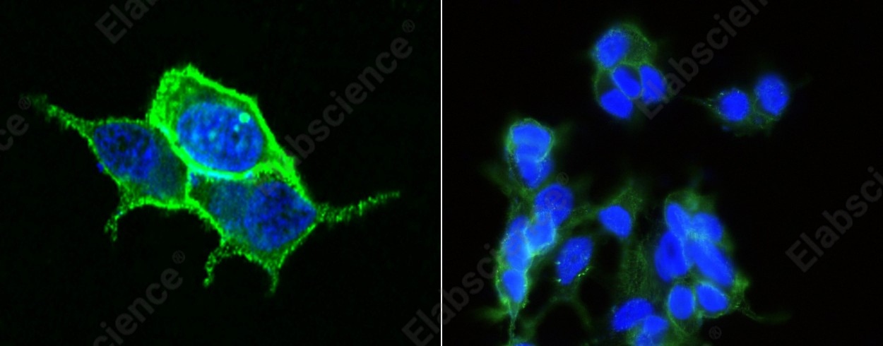 Carbonic Anhydrase XII/CA12 Monoclonal Antibody - 1
