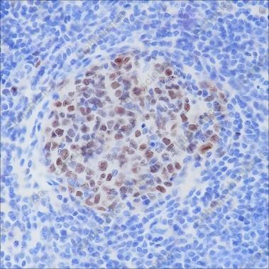 Recombinant BCL6 Monoclonal Antibody - 2