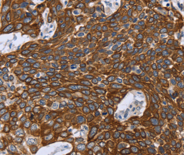 GRPR Polyclonal Antibody - 2