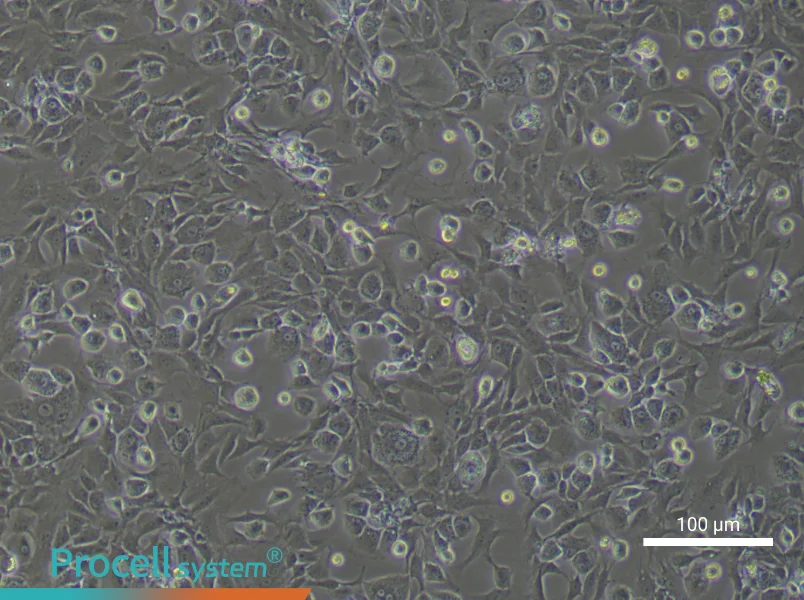 Rat Endplate Chondrocytes - 1