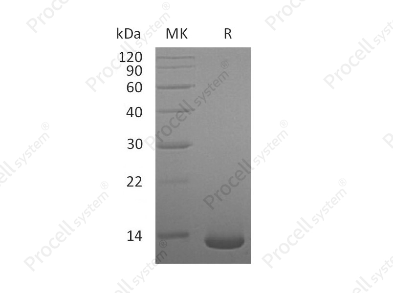 BMP-2/BMP2A, Human, Recombinant