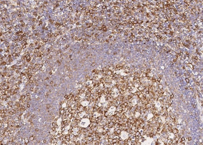 Recombinant CCR1 Monoclonal Antibody - small - 2