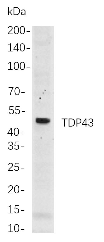 Recombinant TDP43 Monoclonal Antibody-searchlist-1