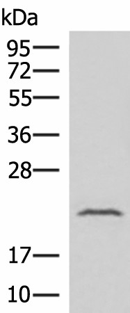 Western blot analysis of Human fetal liver tissue lysate  using IFNA8 Polyclonal Antibody at dilution of 1:500