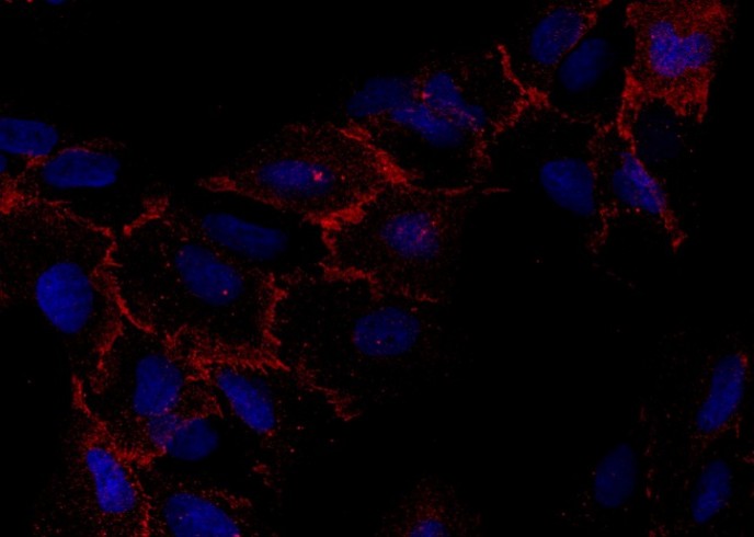 Recombinant CXADR/CAR Monoclonal Antibody - small - 2