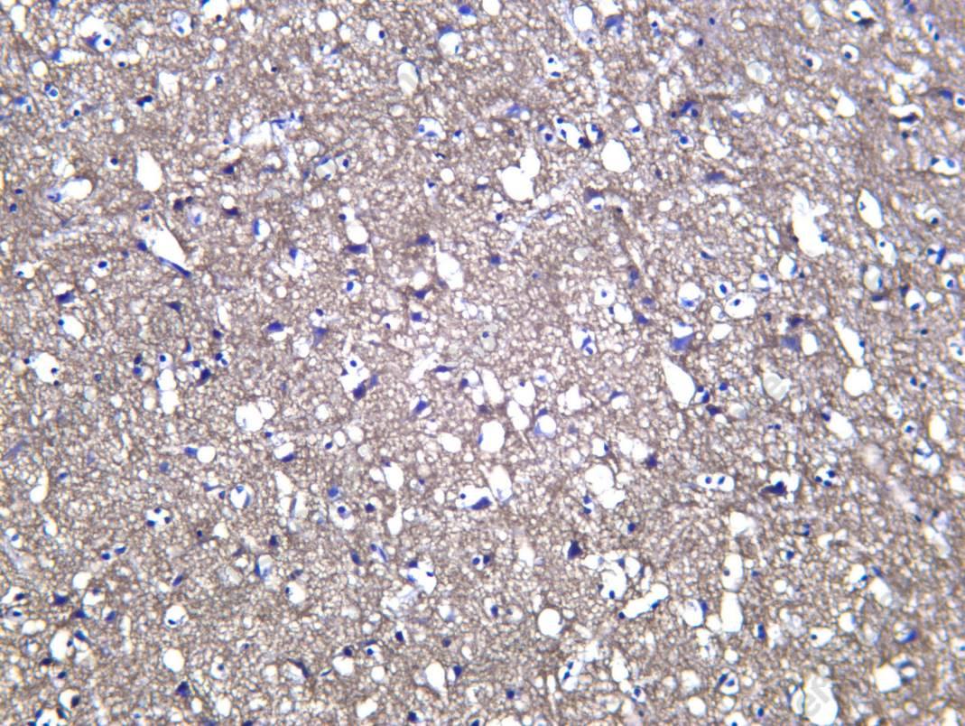 Recombinant CD200 Monoclonal Antibody - 1
