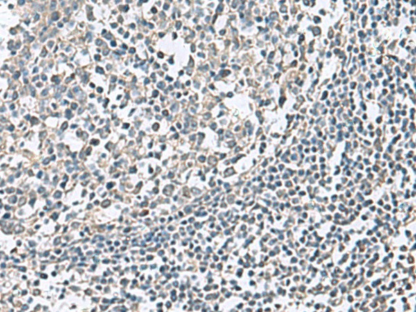 Immunohistochemistry of paraffin-embedded Human tonsil tissue  using NPHP1 Polyclonal Antibody at dilution of 1:75(?200)