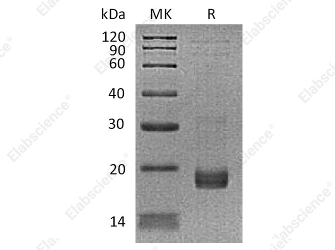 Recombinant Human Troponin C/TNNC1 Protein (His Tag) - 1