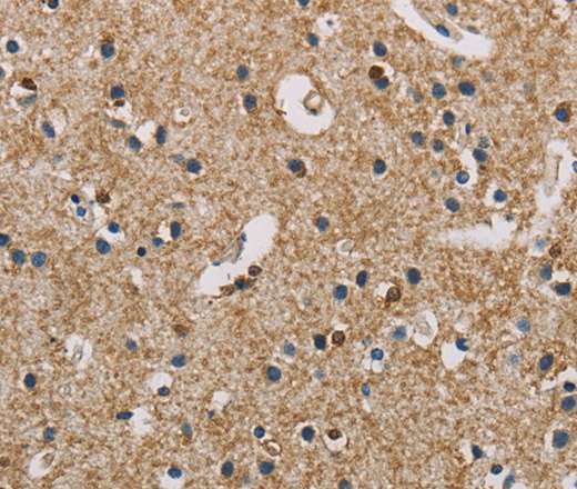 Immunohistochemistry of paraffin-embedded Human brain  using PIP4K2A Polyclonal Antibody at dilution of 1:50