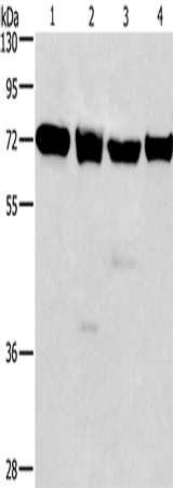 Western Blot analysis of 231, 293T, Raji and hela cell using IL2RB Polyclonal Antibody at dilution of 1:325