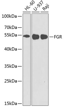 Western blot analysis of extracts of various cell lines using FGR Polyclonal Antibody at dilution of 1:1000.