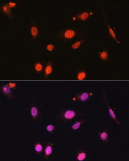 Immunofluorescence analysis of U2OS cells using DDX17 Polyclonal Antibody at dilution of  1:100. Blue: DAPI for nuclear staining.