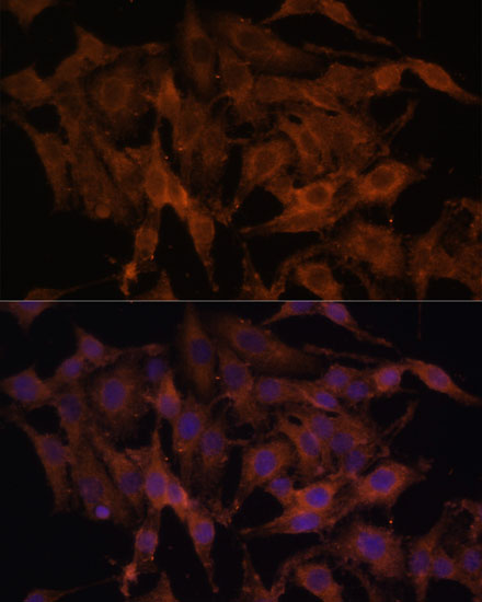 Immunofluorescence analysis of HeLa cells using TLR3 Polyclonal Antibody at dilution of  1:100. Blue: DAPI for nuclear staining.