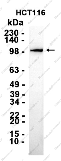 Recombinant VPS11 Monoclonal Antibody - 1