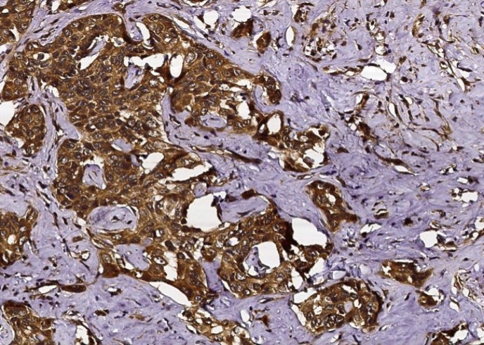 Recombinant CHI3L2/YKL-39 Monoclonal Antibody - small - 2