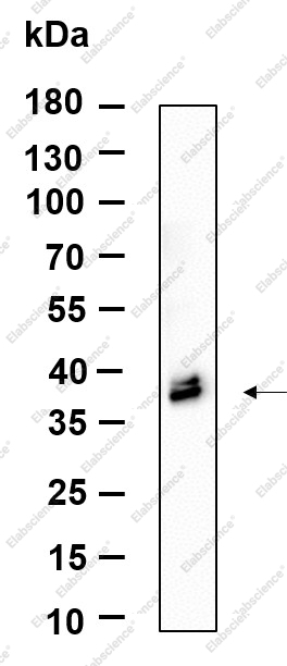 Recombinant ApoE Monoclonal Antibody - 1