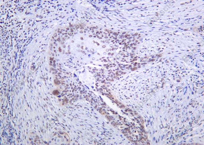 Recombinant SRSF2 Monoclonal Antibody - 1