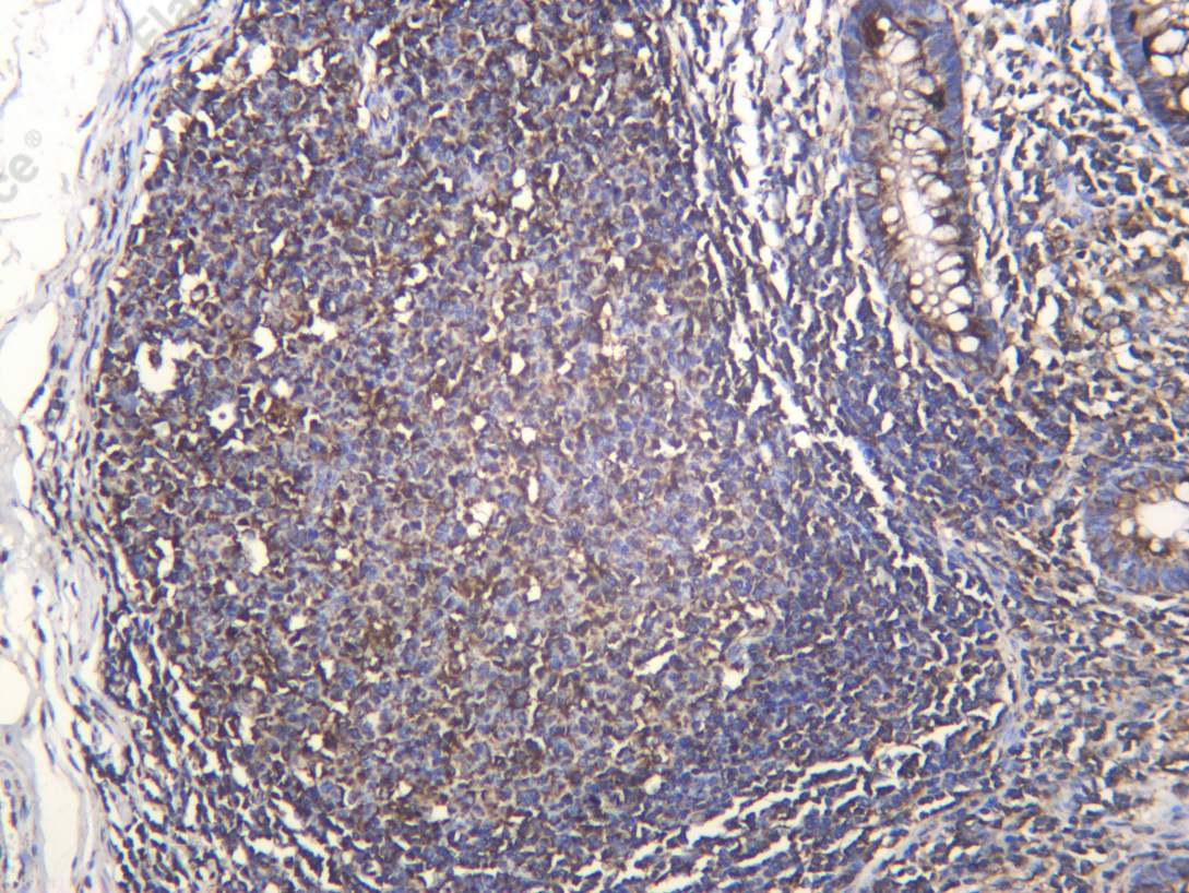 Recombinant Citrate Synthetase Monoclonal Antibody - 1