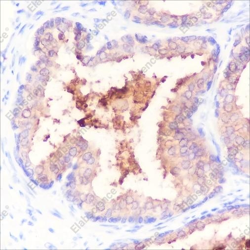 Recombinant PSA Monoclonal Antibody - 2