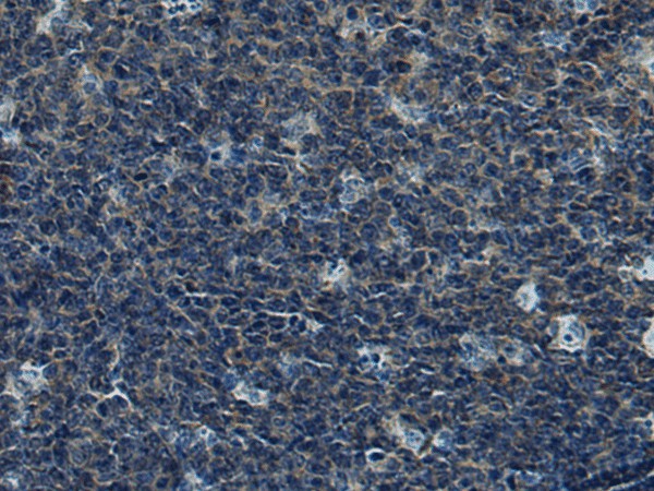 Immunohistochemistry of paraffin-embedded Human tonsil tissue  using CUL5 Polyclonal Antibody at dilution of 1:55(?200)