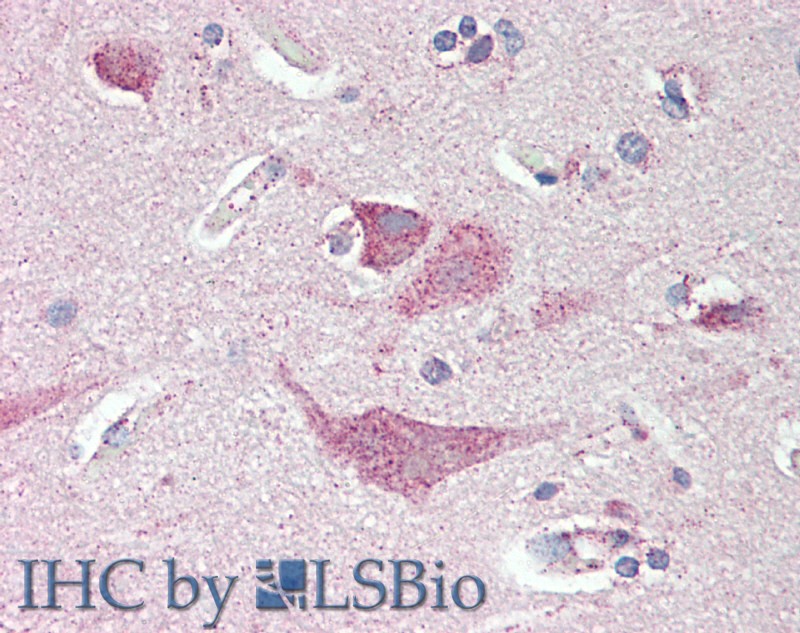 Immunohistochemistry of paraffin-embedded Brain Cortex tissue using SLC8A3 Polyclonal Antibody at dilution of 1:80 (Elabscience Product Detected by Lifespan).