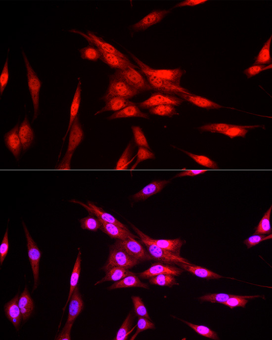 Immunofluorescence analysis of NIH/3T3 cells using FBXW11 Polyclonal antibody at dilution of 1:200 (40x lens). Blue: DAPI for nuclear staining.