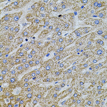Immunohistochemistry of paraffin-embedded Human liver damage using Gm13125 Polyclonal Antibody at dilution of 1:100 (40x lens).