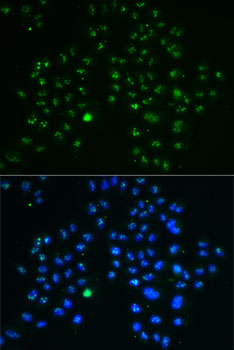 Immunofluorescence analysis of MCF7 cells using GNL3 Polyclonal Antibody