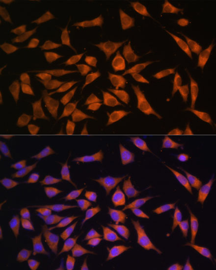 Immunofluorescence analysis of L929 cells using PMM2 Polyclonal Antibody at dilution of 1:100. Blue: DAPI for nuclear staining.