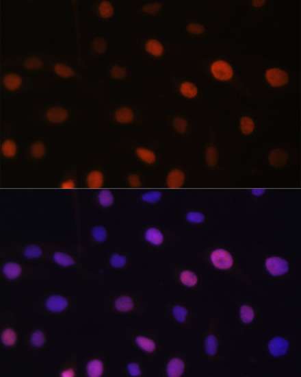 Immunofluorescence analysis of U-2 OS cells using UHRF2 Polyclonal Antibody at dilution of 1:100. Blue: DAPI for nuclear staining.