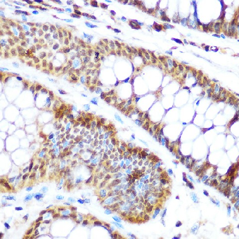 Immunohistochemistry of paraffin-embedded human colon using SP3 Polyclonal Antibody at dilution of 1:100 (40x lens).Perform microwave antigen retrieval with 10 mM Tris/EDTA buffer pH 9.0 before commencing with IHC staining protocol.