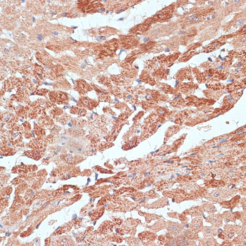 Immunohistochemistry of paraffin-embedded Mouse heart using TMX1 Polyclonal Antibody at dilution of  1:100 (40x lens).