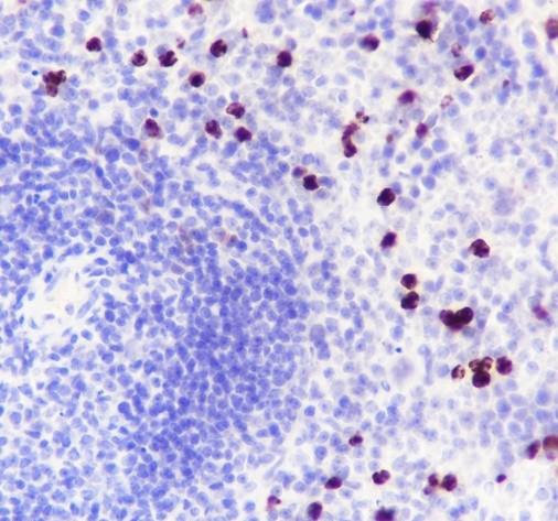 Recombinant MMP8 Monoclonal Antibody - 2