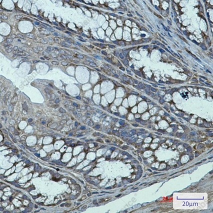 Recombinant Transglutaminase 2 Monoclonal Antibody - 4