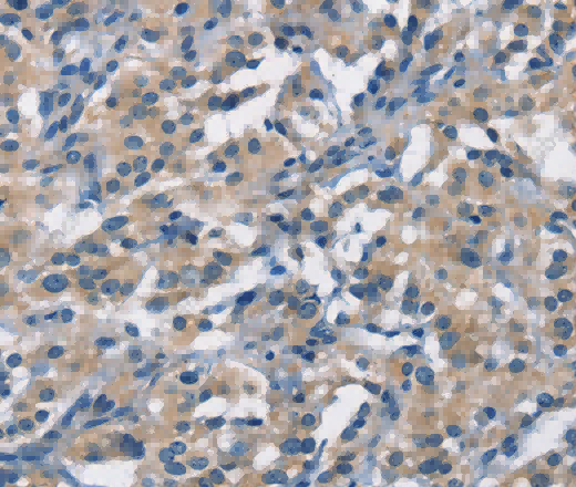 APOL1 Polyclonal Antibody - 3