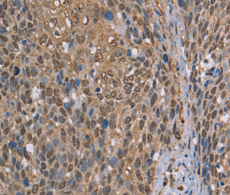 CAB39 Polyclonal Antibody - 2
